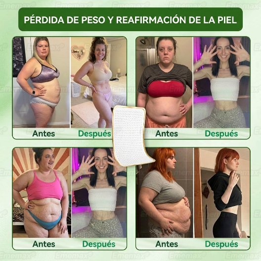 🍌🍌[𝐍𝐨𝐯𝐞𝐝𝐚𝐝 𝐲 𝐦𝐞𝐣𝐨𝐫𝐚 𝟐𝟎𝟐𝟔: ¡𝟖𝟎% 𝐝𝐞 𝐝𝐞𝐬𝐜𝐮𝐞𝐧𝐭𝐨!] ✅ 𝐄𝐦𝐞𝐦𝐚𝐱®𝐏𝐀𝐑𝐂𝐇𝐄 𝐍𝐀𝐍𝐎 𝐌𝐈𝐂𝐑𝐎𝐍𝐄𝐄𝐃𝐋𝐄 𝐀𝐃𝐄𝐋𝐆𝐀𝐙𝐀𝐍𝐓𝐄 𝐃𝐑𝐄𝐍𝐀𝐉𝐄 𝐋𝐈𝐍𝐅𝐀𝐓𝐈𝐂𝐎 — 𝐀𝐝𝐞𝐦á𝐬: 𝐚𝐥𝐢𝐯𝐢𝐨 𝐚𝐫𝐭𝐢𝐜𝐮𝐥𝐚𝐫, 𝐦𝐞𝐣𝐨𝐫 𝐝𝐞𝐬𝐜𝐚𝐧𝐬𝐨 𝐲 𝐜𝐥𝐚𝐫𝐢𝐝𝐚𝐝 𝐦𝐞𝐧𝐭𝐚𝐥.
