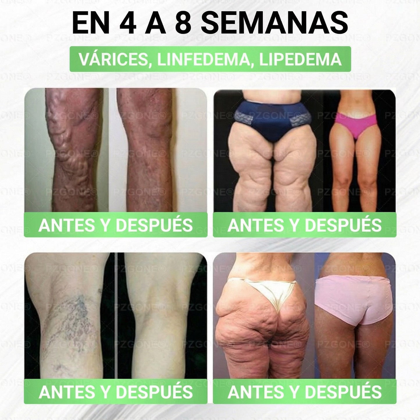 𝑳𝒖𝒙𝒂𝒓𝒊𝒔𝒆®  🌵 Moringa & Berberina 10 en 1 Parche Avanzado de Microagujas Nano (Uso diario, cambios visibles en 7 días) 👩‍⚕️ Obesidad, Diabetes, Apnea del Sueño y Problemas Articulares