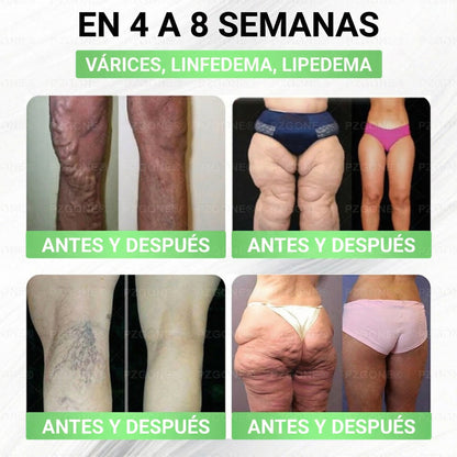 𝑳𝒖𝒙𝒂𝒓𝒊𝒔𝒆®  🌵 Moringa & Berberina 10 en 1 Parche Avanzado de Microagujas Nano (Uso diario, cambios visibles en 7 días) 👩‍⚕️ Obesidad, Diabetes, Apnea del Sueño y Problemas Articulares